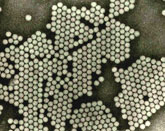 ポリオウイルスの電子顕微鏡写真